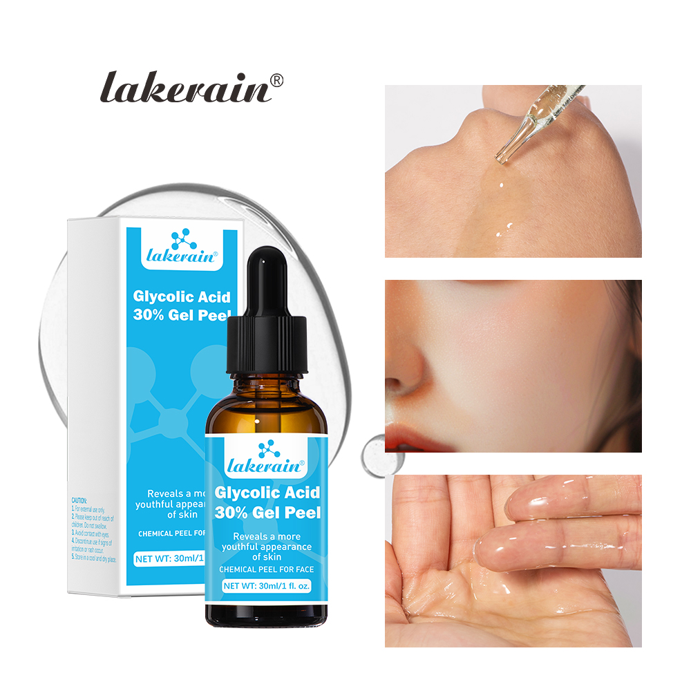 Lactic Acid Toner - 30 % Glykolsäure-Peeling-Gel, professionelle chemische Gesichtspeeling