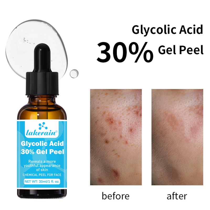 Lactic Acid Toner - 30 % Glykolsäure-Peeling-Gel, professionelles chemisches Gesichtsschalen-Kollagen,