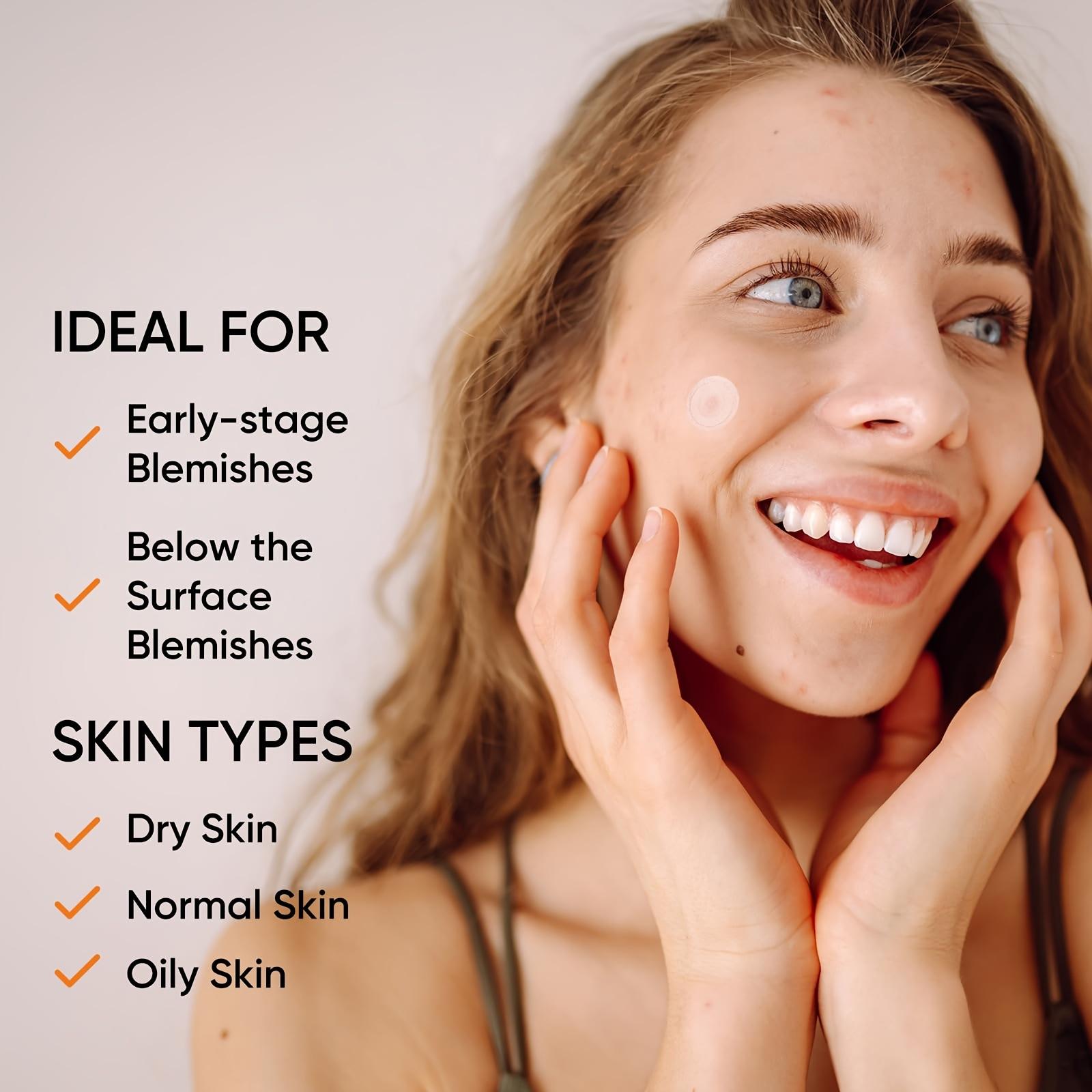 Große Hydrogel-Akne-Pflaster X – Xl Skincare Bewertung und Preis