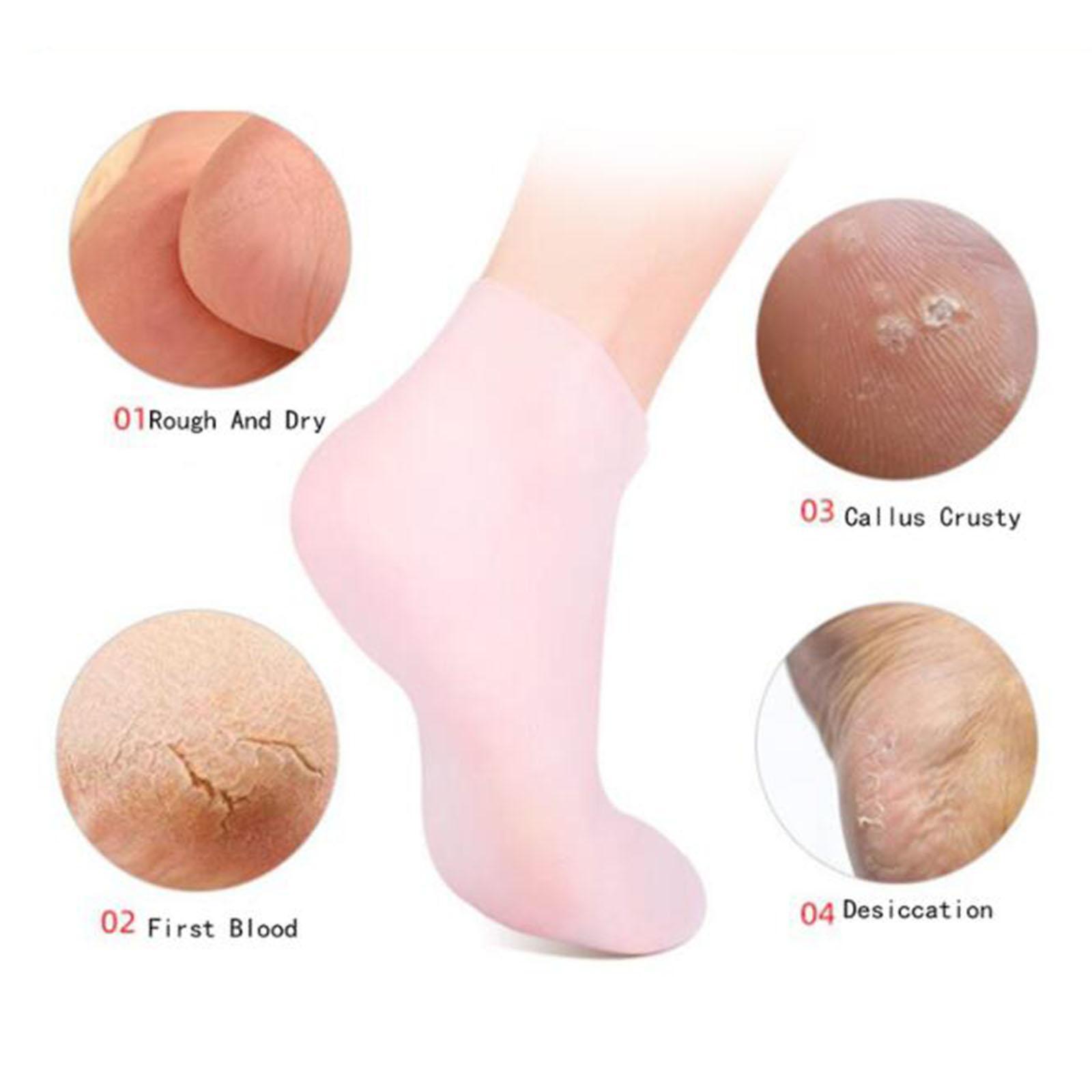 Weiche Silikongelsocken Zehens – Xl Skincare Bewertung und Preis